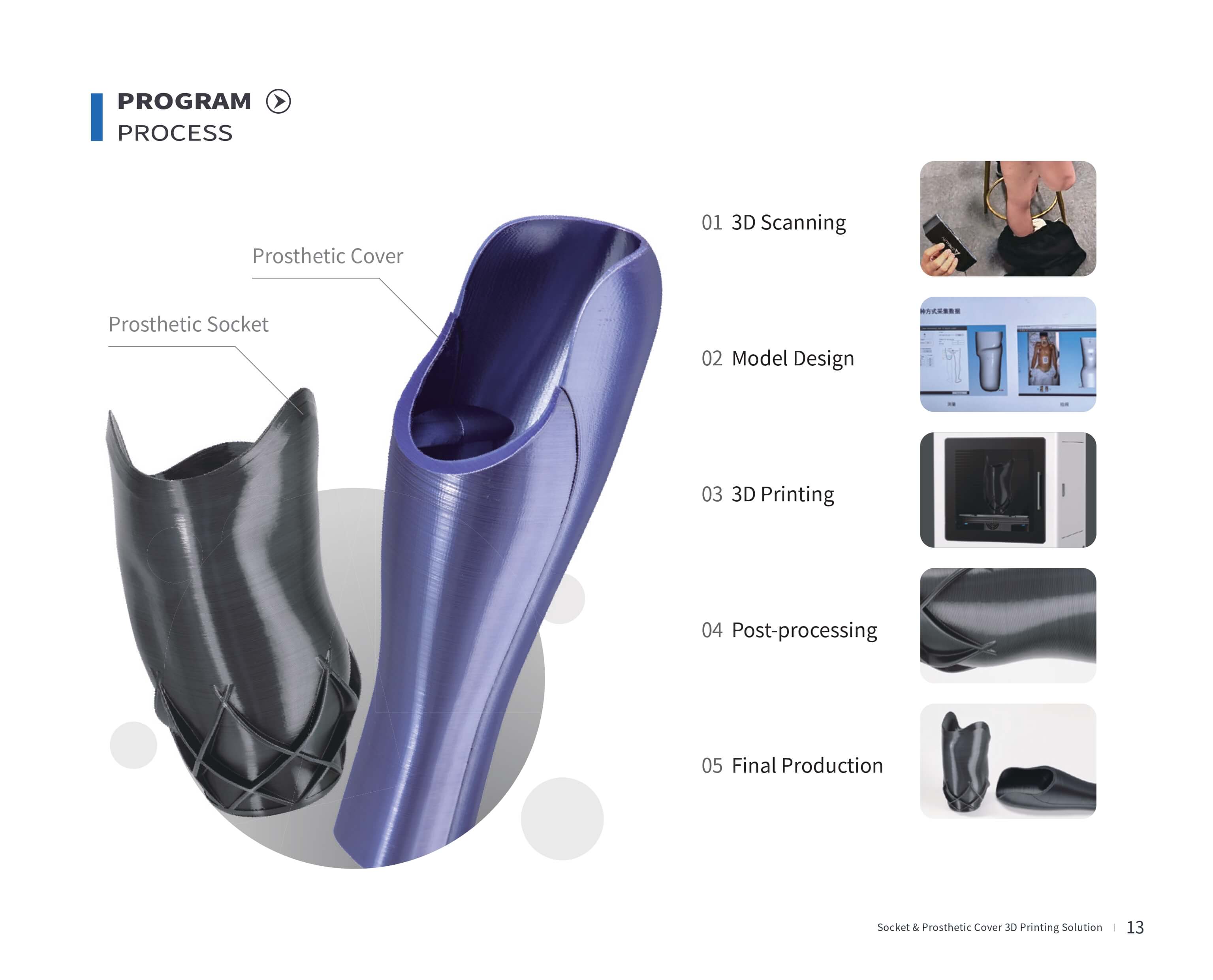 Prosthetic Solutions